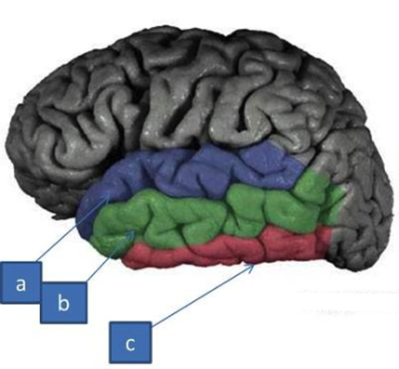 <p>divide the temporal lobe into superior temporal gyrus, middle temporal gyrus, and inferior temporal gyrus</p>