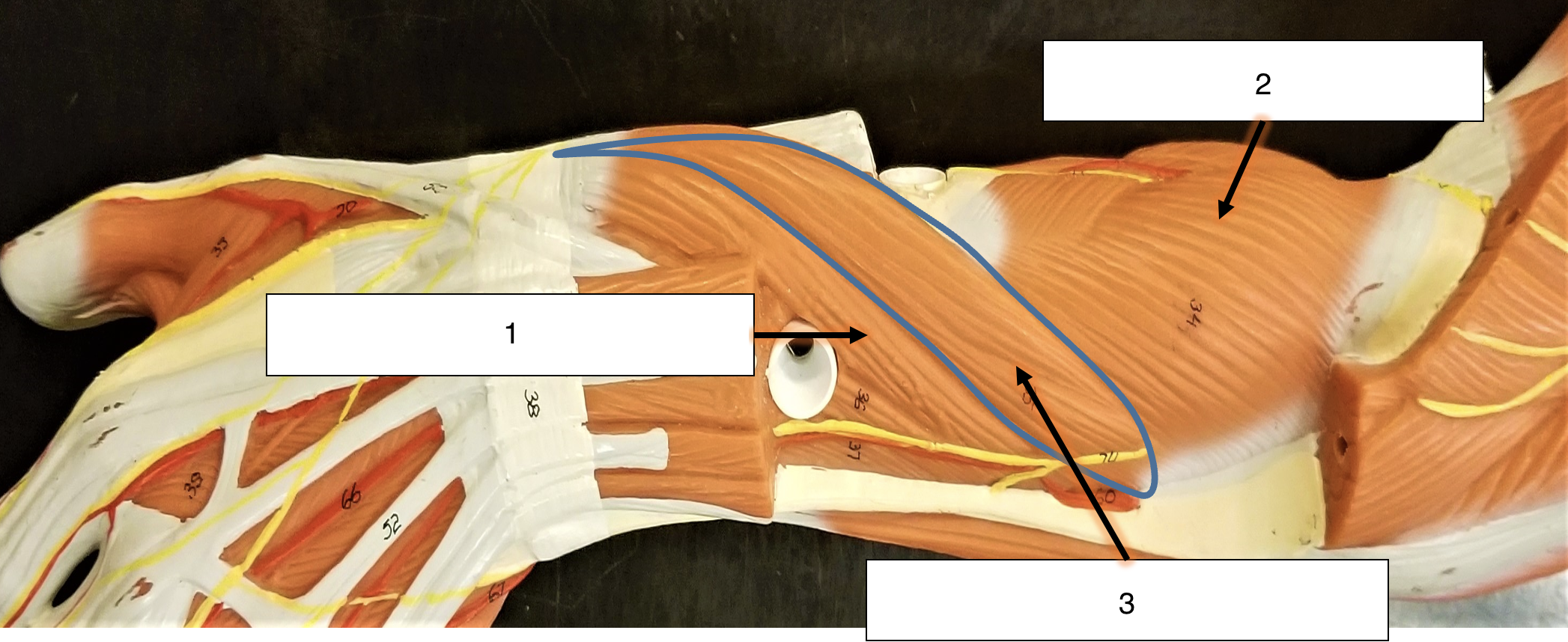 <p>name the muscle (2)</p>