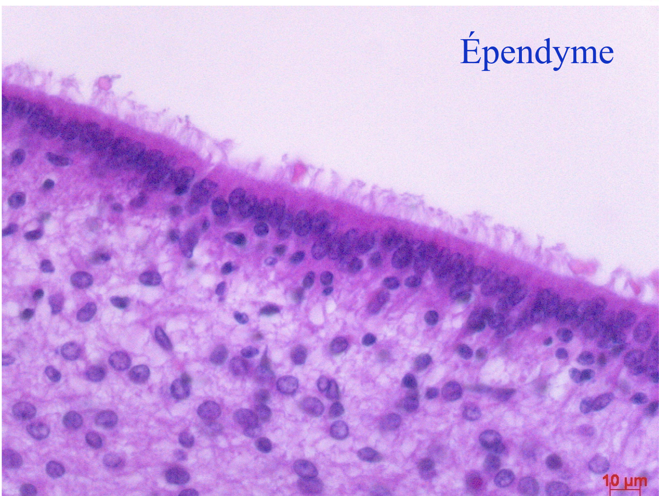 <p>tapissent les parois des ventricules</p><p>sont pourvues de cils</p><p>jouent un role dans la dynamique du LCR</p>