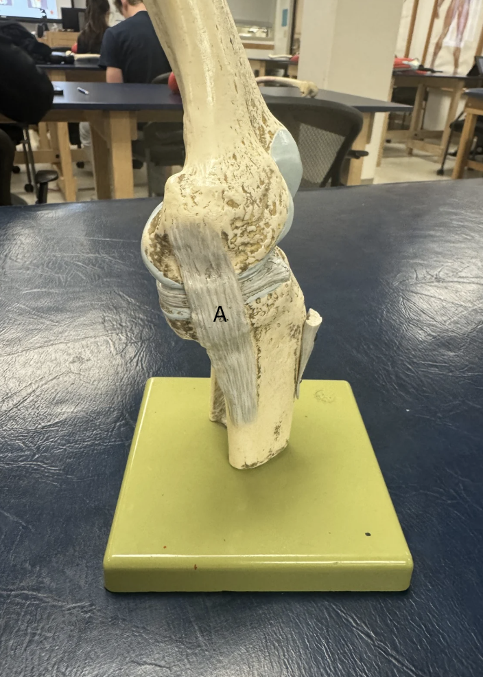 <p>Label this ligament</p>