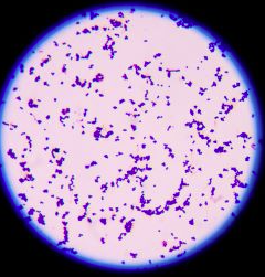 <p>Is this gram-positive or gram-negative bacteria (purple)</p>