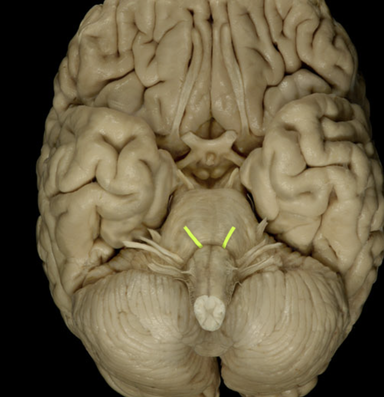 term image