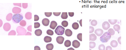 <p>What is the genus, species, and stage of this parasite?</p>