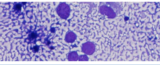 <p>Différentiel d’un pattern “tigroid”</p>