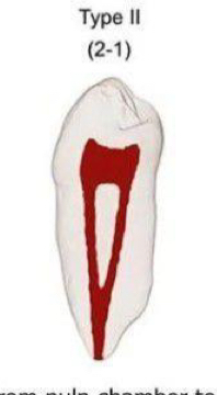 <p><span>Two separate canals leve chamber but merge at canal terminus to form a single canal</span></p>