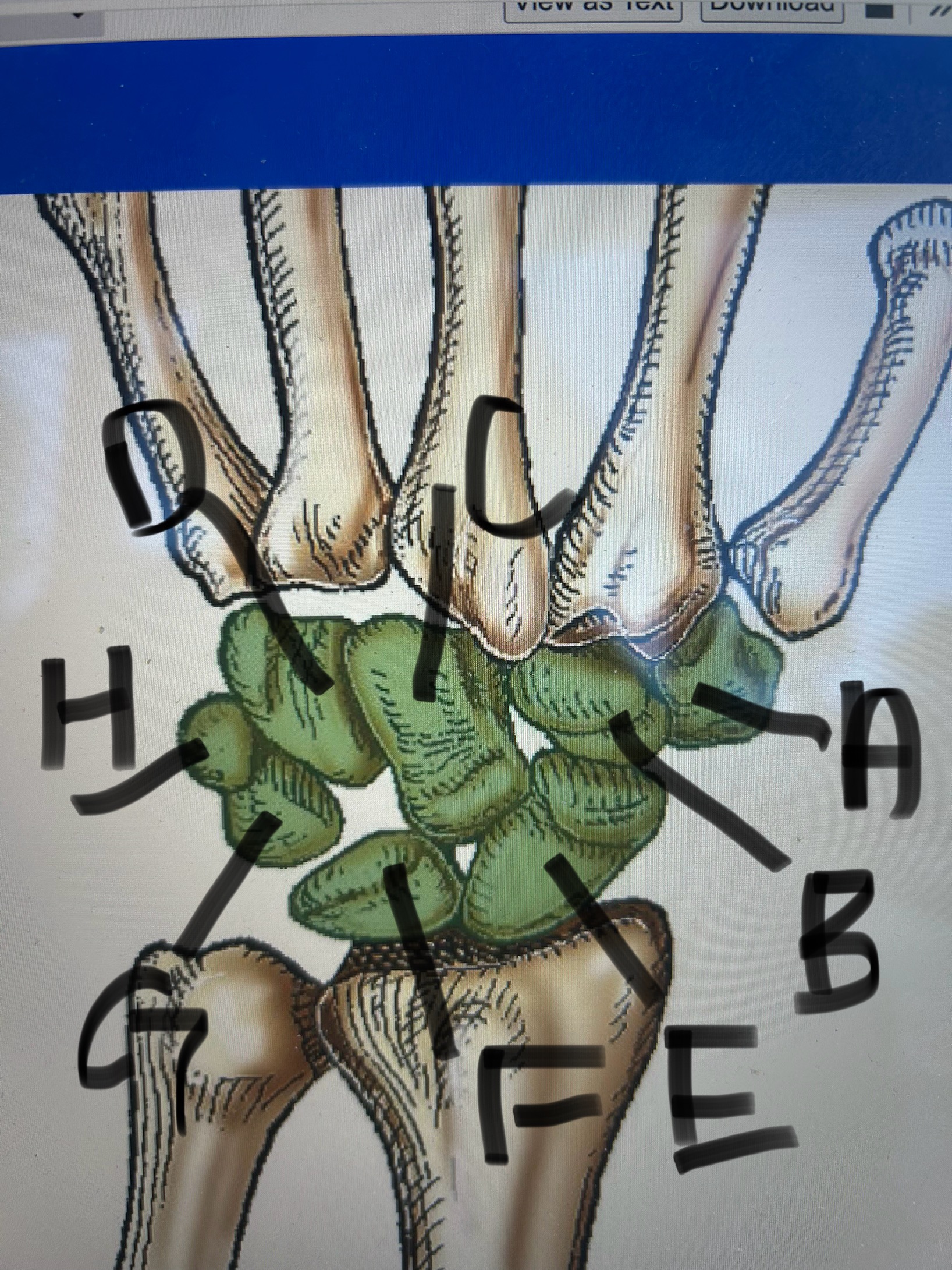 <p>label this image</p>