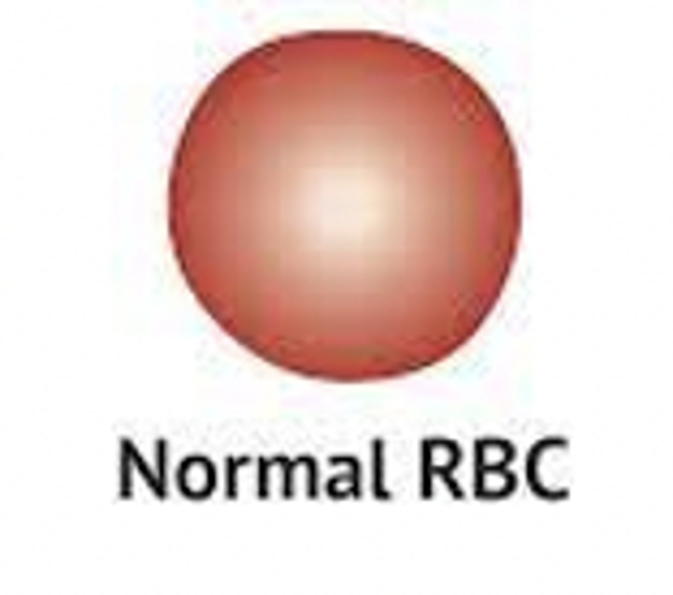 <p>what is an example of normochromic anemia?</p>