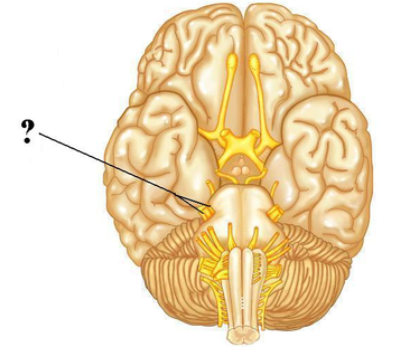 <p><span><span>Identify the indicated cranial nerve.</span></span></p>