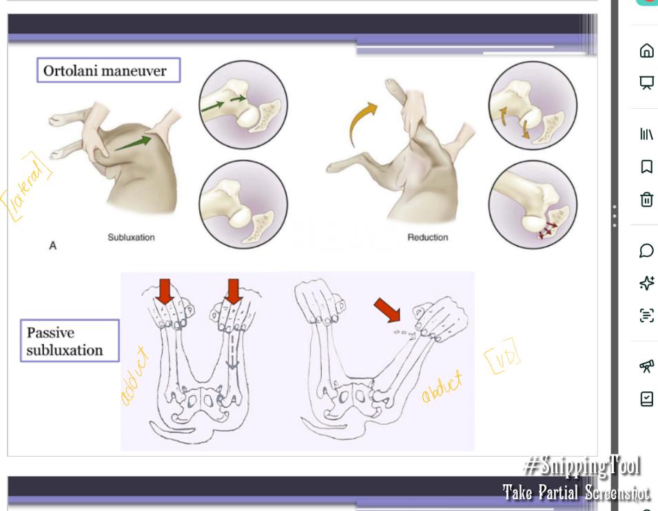 <ul><li><p><span style="background-color: transparent;"><strong><span>Ortolani maneuver:</span></strong></span><span style="background-color: transparent; color: red;"><strong><span> </span></strong><u><span>angle of reduction</span></u></span><span style="background-color: transparent;"><u><span> → </span></u><strong><u><span>evaluates for laxity</span></u></strong></span></p><ul><li><p><span style="background-color: transparent;"><strong><span>How: </span></strong><span>Force femur to subluxate then reduce, done </span><u><span>under sedation</span></u></span></p></li><li><p><span style="background-color: transparent;"><strong><span>Results: </span></strong></span></p><ul><li><p><span style="background-color: transparent;"><u><span>‘Clunk’ = laxity present</span></u></span></p></li><li><p><span style="background-color: transparent;"><u><span>‘Clunk’ = reduction of hip</span></u></span></p><ul><li><p><span style="background-color: transparent;"><span>No laxity, shallow acetabulum, severe OA</span></span></p></li></ul></li></ul></li></ul></li><li><p><span style="background-color: transparent;"><strong><span>Barlow test:</span></strong><span> </span></span><span style="background-color: transparent; color: red;"><u><span>angle of subluxation</span></u></span></p><ul><li><p><span style="background-color: transparent;"><strong><span>How:</span></strong><span> Force femur to subluxate</span></span></p><ul><li><p><span style="color: green;">1st ½ of ortolani maneuver → “how far can we get them to luxate”</span></p></li></ul></li></ul></li><li><p><span style="background-color: transparent;"><strong><span>Barden test</span></strong></span></p><ul><li><p><span style="background-color: transparent;"><strong><span>How:</span></strong><span> </span></span><span style="background-color: transparent; color: red;"><span>Laterally displace femur</span></span></p></li></ul></li></ul><p></p>