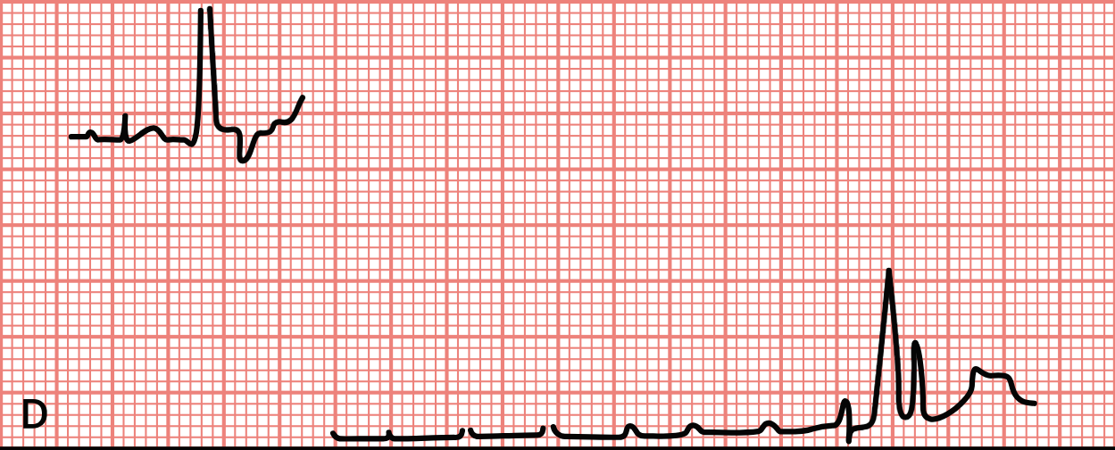 <p>Which type of artifact is shown in this image?</p>