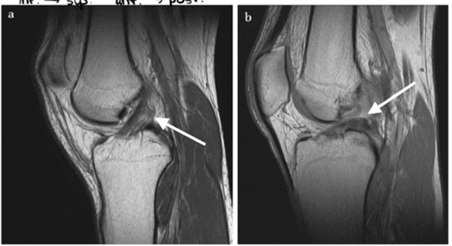 <p>What is the difference between image a and b?</p>