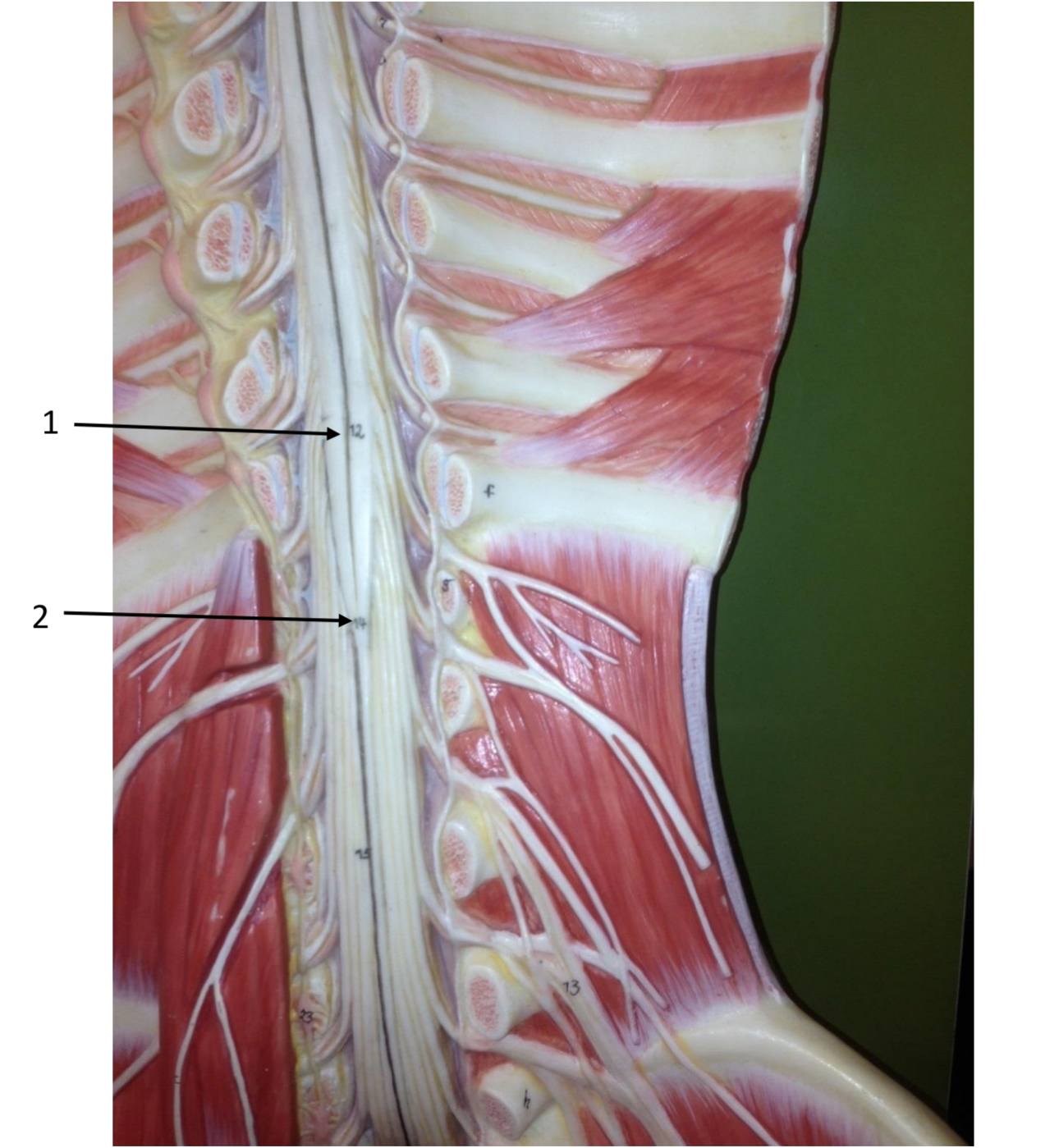 <p>What is 1 pointing to</p>