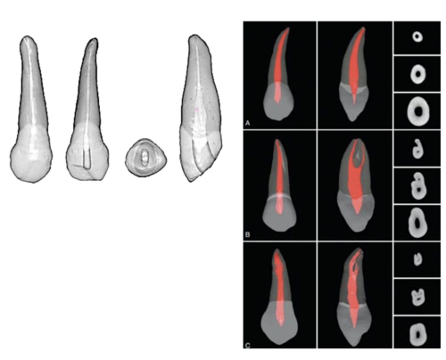 <p>maxillary canine</p>