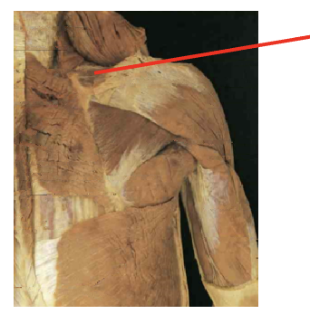 <p>What muscle is thisWhat is its origin. Where does it inserts. </p>