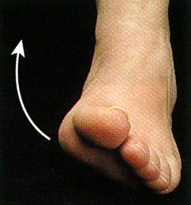 <p>Turning the sole of the foot inward</p>