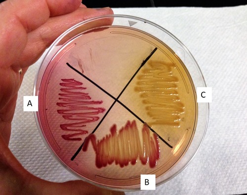 Which organism(s) shown on this MAC plate are lactose fermenters?