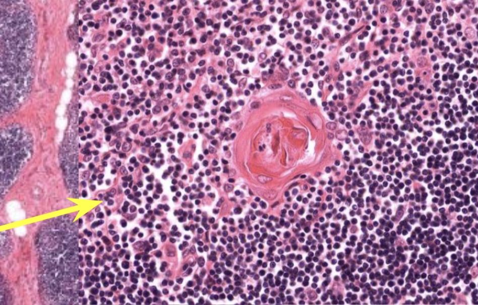 <p>Thymus! In the Medulla</p>