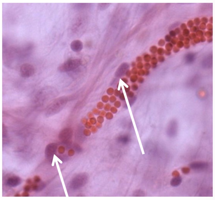 <p>Prie kapiliaru ir pokapiliariniu venuliu</p>