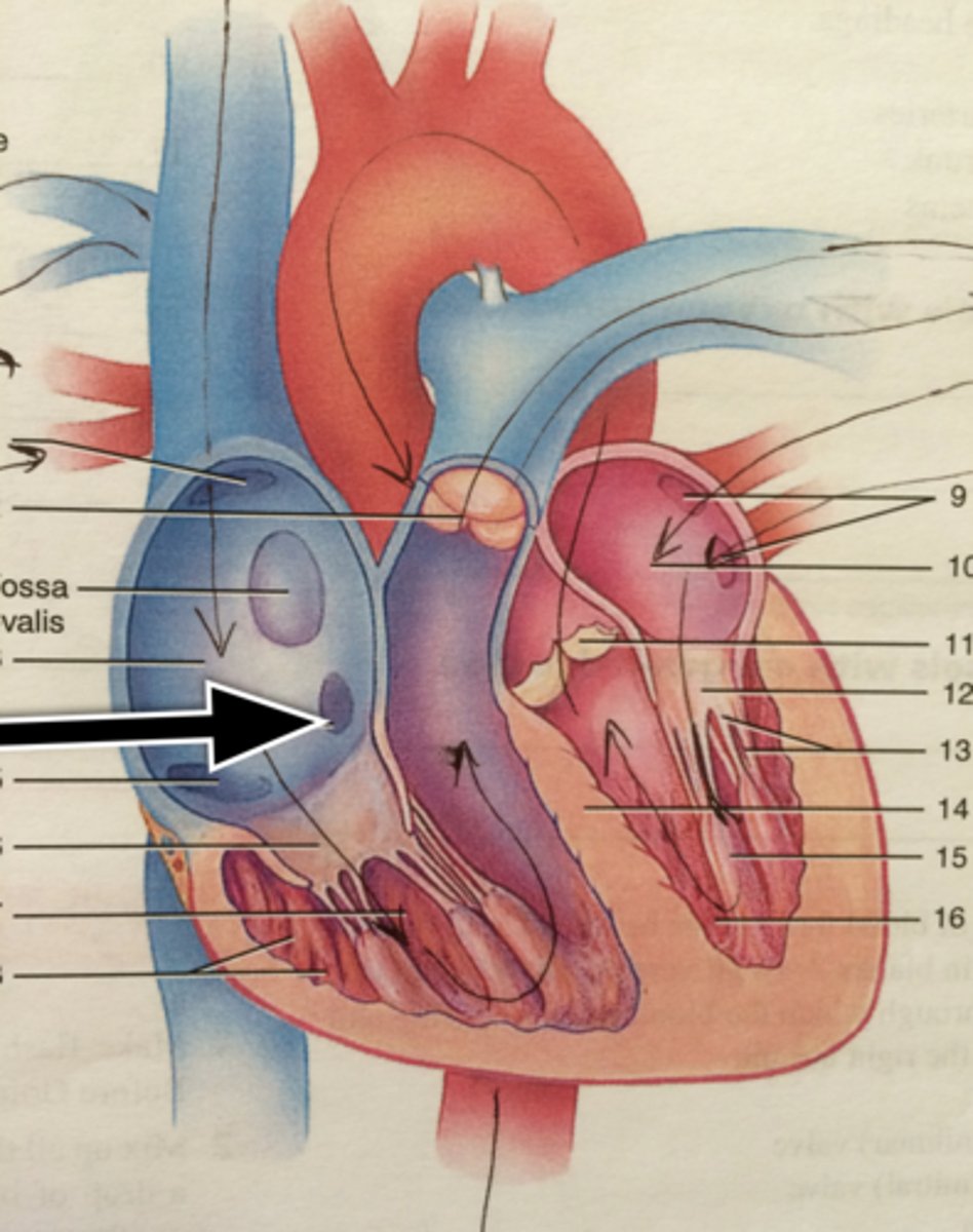 <p>short trunk receiving most cardiac veins, between the right Atrioventricular. orifice and the Inferior vena cava orifice</p>
