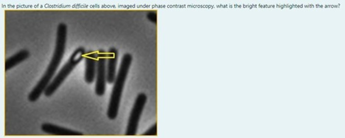 <p>A spore</p><p>3 multiple choice options</p>