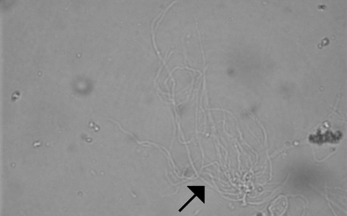 <p>semi-transparent under brightfield microscopy and could be mistaken for hyaline casts. They are ribbon-like strands with poorly defined edges, pointed or split ends, and longitudinal striations.</p>