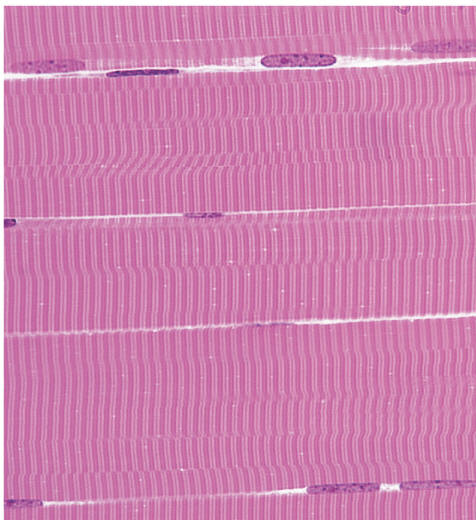 <p>Skeletal Muscles </p>