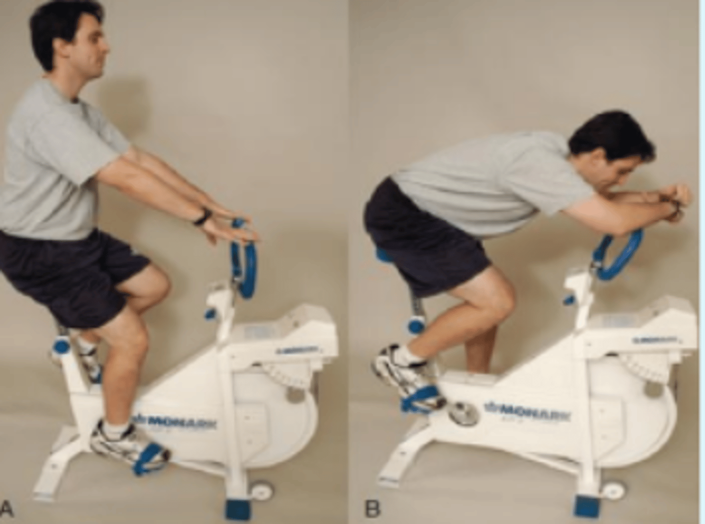 <p>- intermittent claudication and spinal stenosis</p><p>- The patient is seated on an exercise bicycle and is asked to pedal against resistance. The patient starts pedaling while leaning backward to accentuate</p><p>the lumbar lordosis. If pain into the buttock and posterior thigh occurs, followed by tingling in the affected lower extremity, the first part of the test is positive. The patient is then asked to lean forward while continuing to pedal. If the pain subsides over a short period of time, the second part of the test is positive; if the patient sits upright again, the pain returns. A patient with intermittent claudication of the lower extremities typically experiences an increase in symptoms with continued exercise, regardless of the position of the spine.</p>