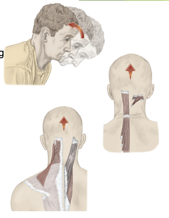 Cervical Extension