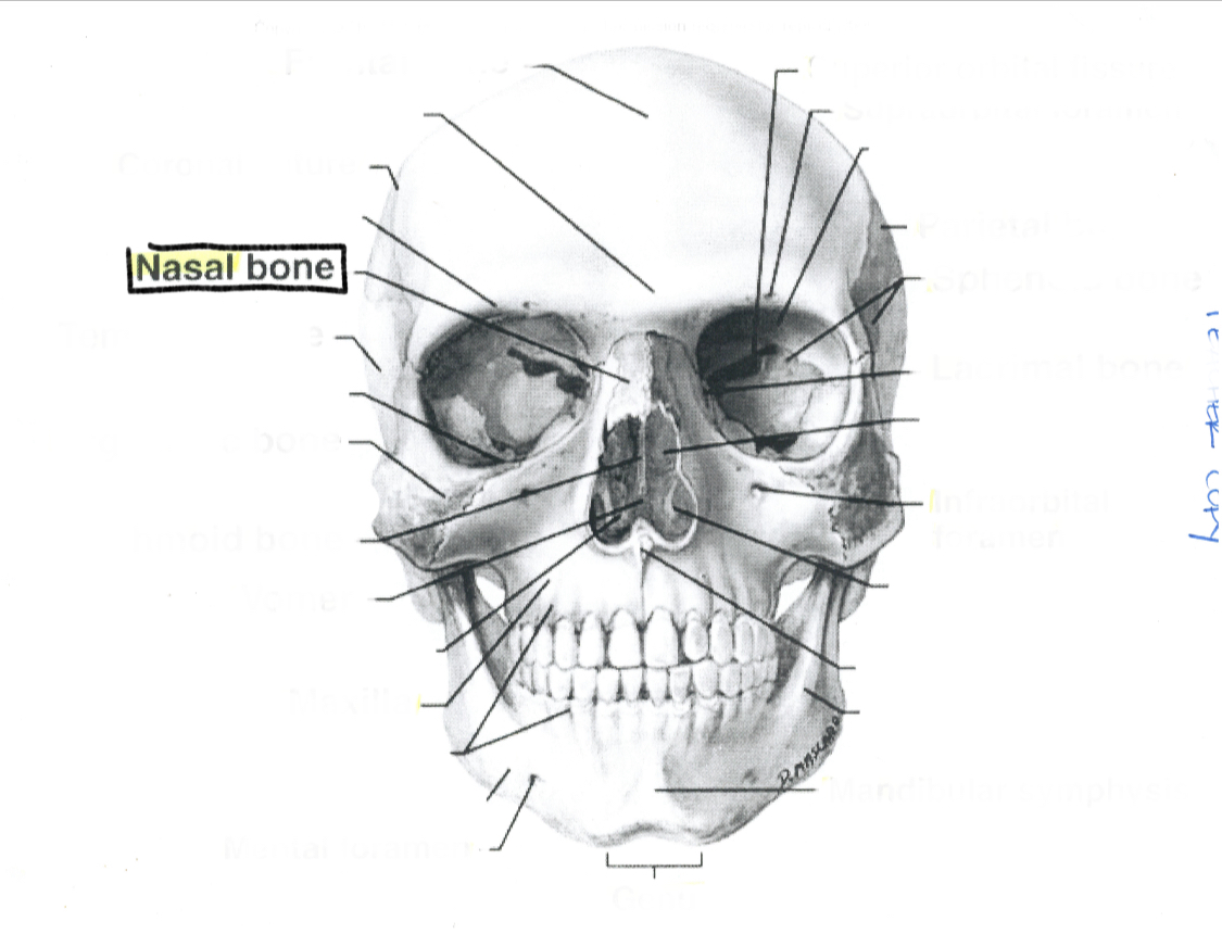 <p>Nasal bone</p>