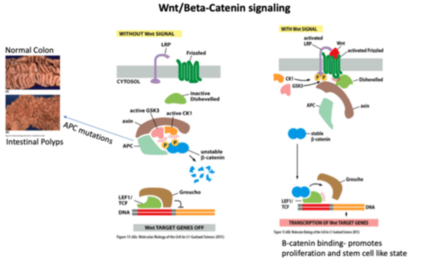 <p>without Wnt, beta catenin becomes unstable, and transcription DOES NOT occur</p><p>WITH Wnt signaling, beta catenin is stable YAY, and transcription DOES OCCUR!</p><p>with APC mutations beta catenin is always stable and results in UNCONTROLLED GROWTH AND POLYPS</p>