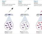 <p>How does gram staining work?</p>