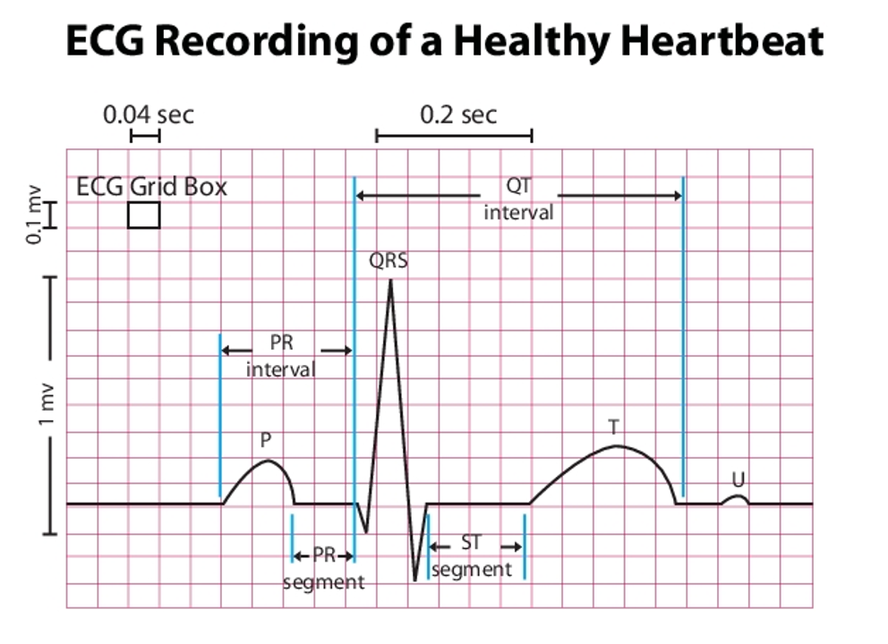 <p>How many boxes should your QT interval be in a normal healthy heartbeat? (beginning of Q to end of T)</p>