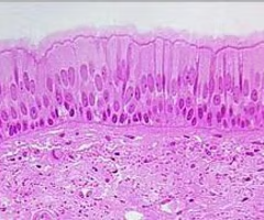 <p>single layer of cells that appears to be made up of multiple layers of cells; each cell may have different heights/nucleus positions</p><ul><li><p><strong>secretes substances</strong>, particularly mucus;<strong> propulsion of mucus by ciliary action</strong></p></li><li><p>ciliated variety lines the <strong>trachea</strong>, most of the upper respiratory tract; <strong>males sperm carrying duct</strong></p></li></ul><p></p>