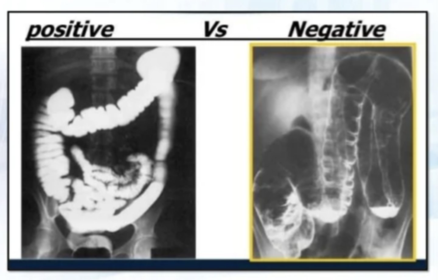 <p>positive and negative</p>