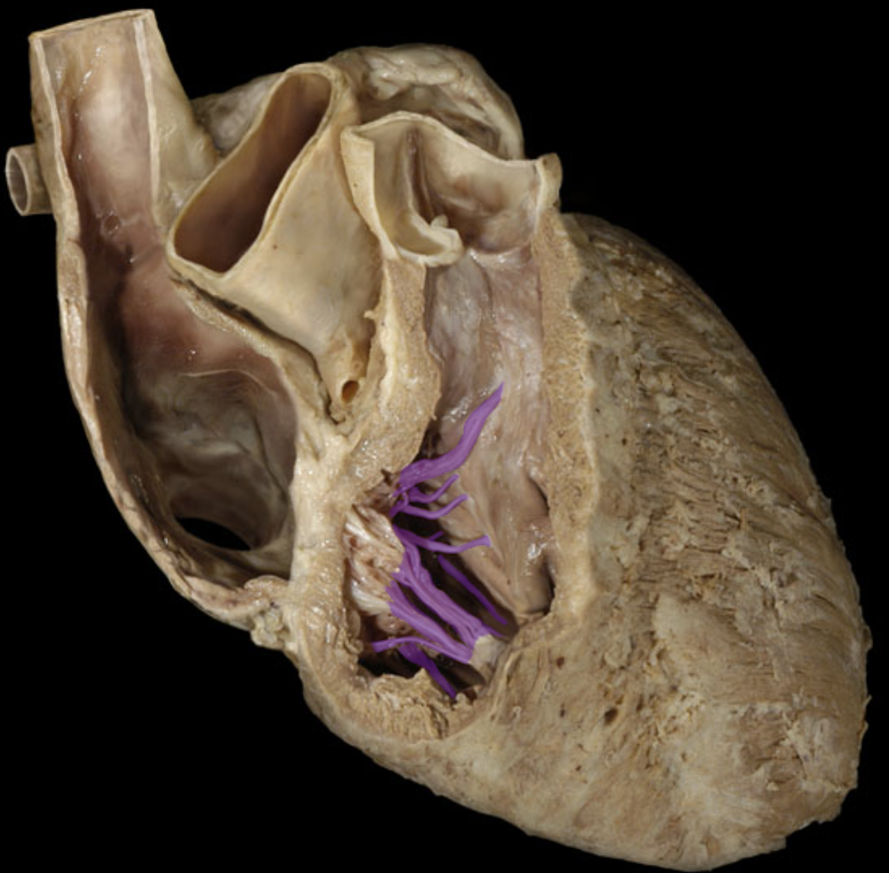 <p>Chordae Tendineae</p>