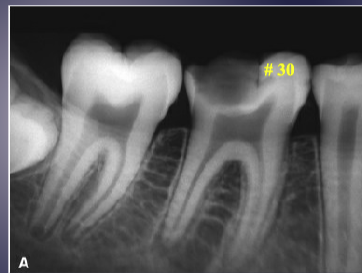 <p>differentiate the pathology for #30 + #31 </p>