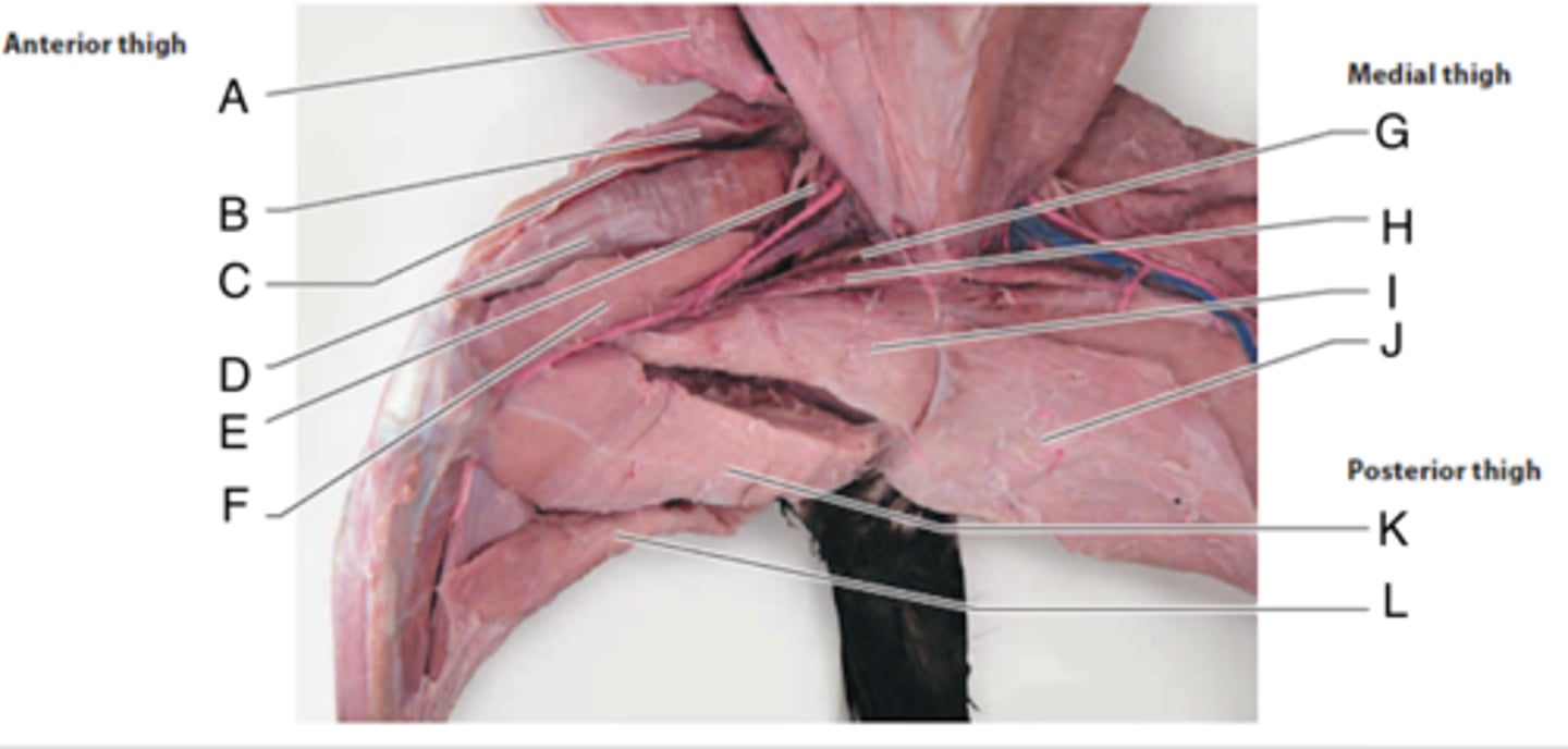 <p>What is the muscle indicated by letter L? What is an attachment point and function?</p>