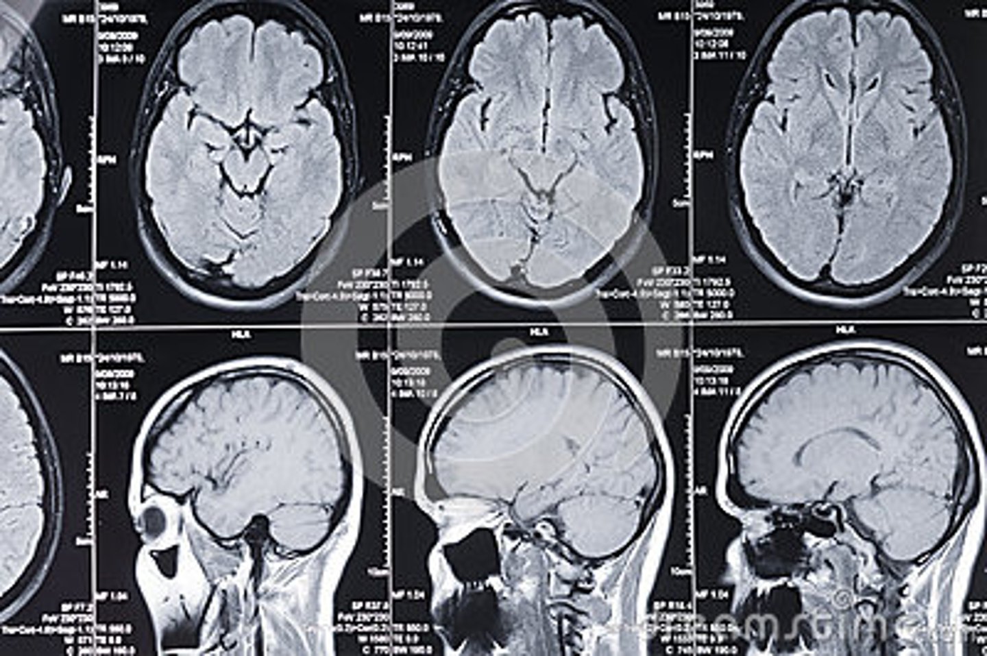 <p>x-ray of the brain</p>