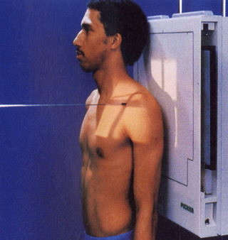 <p> AP clavicle</p><ul><li><p><span>posterior aspect closest to receptor</span></p></li><li><p><span>patient erect&nbsp;</span></p></li><li><p><span>full inhalation</span></p></li></ul><p></p>