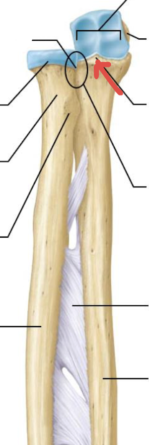 <p>what is this part of the ulna?</p>