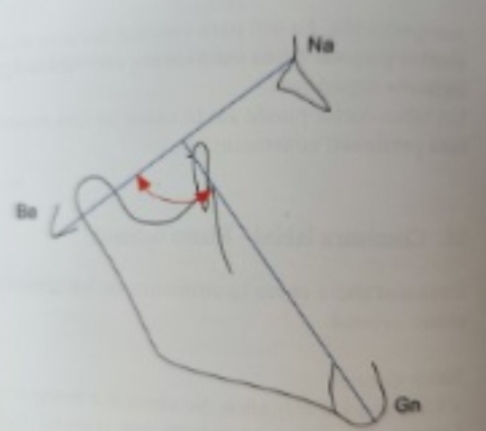 <p>Angle between<strong> Facial axis </strong>and <strong>Ba-Na plane</strong></p><p class="has-focus"></p><p class="has-focus is-empty"><strong>Higher - Dolichofacial</strong></p><p class="has-focus"><strong>Lower - Brachyfacial</strong></p>