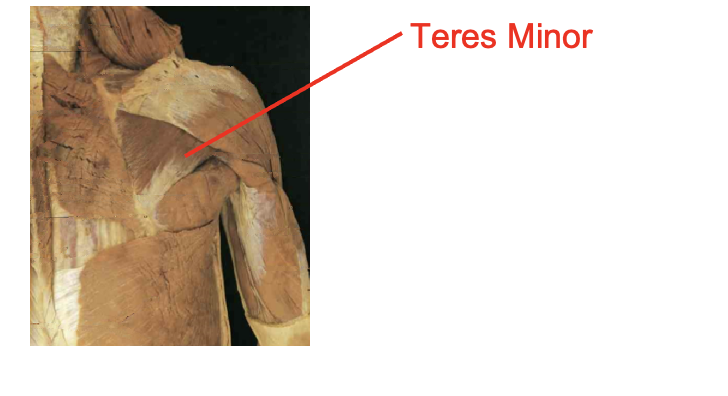 <p>Teres minor</p><p>Origin</p><ul><li><p>superior axillary border</p></li></ul><p>Inserition</p><ul><li><p>inferiro greater tubercle</p></li></ul><p></p><img src="https://knowt-user-attachments.s3.amazonaws.com/63d9258a-1873-41f9-88b7-151fd2272fd9.png" data-width="100%" data-align="center"><p></p>
