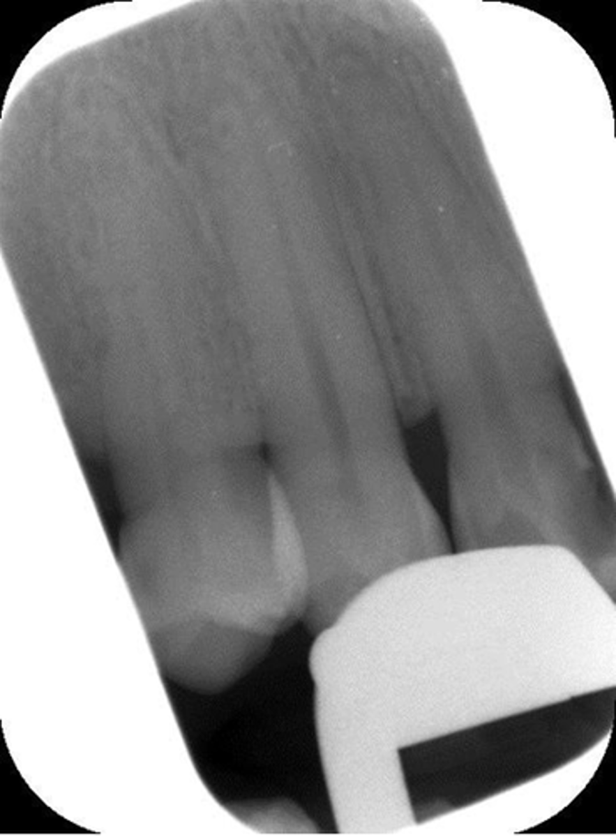 <p>Scanning error caused by</p>