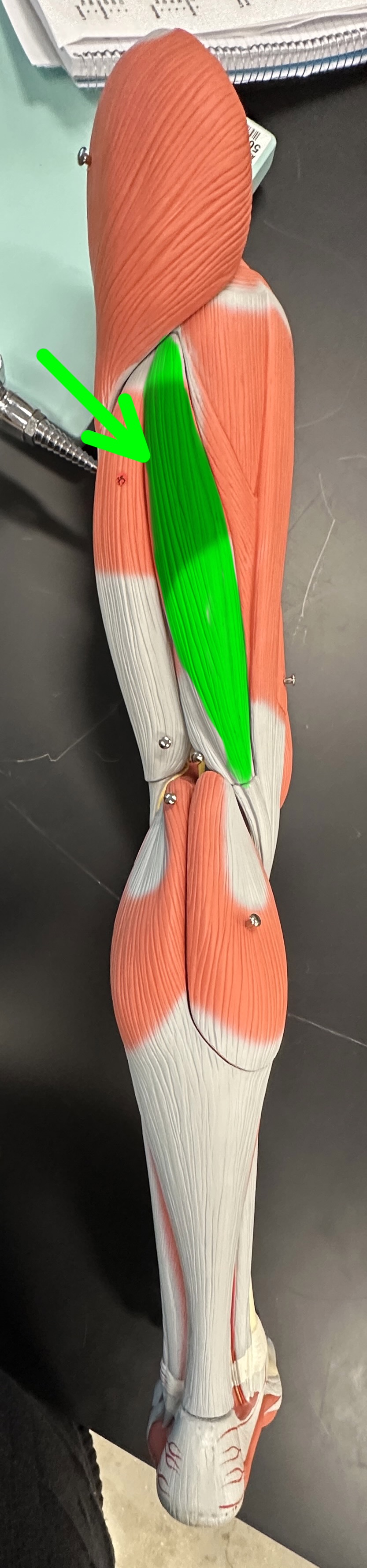 <p>What is the highlighted structure</p>