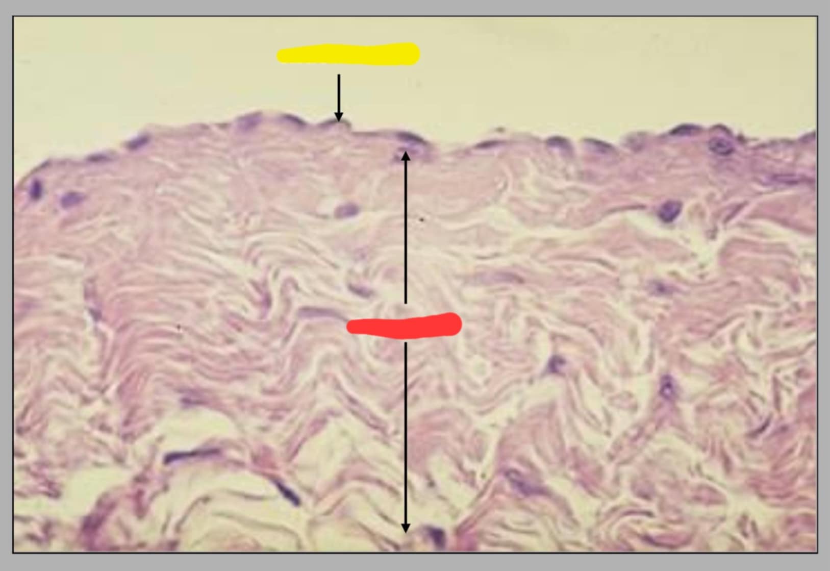 <p>name of the slide and its parts</p>