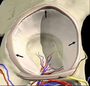 lip of fibrocartilage that surrounds outer margin of the acetabulum on the hip bone
