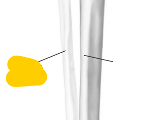 <p><span>quel est cette partie? du tibia</span></p>