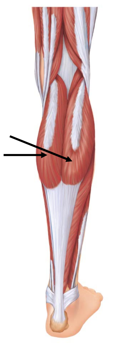 <p>The insertion for the muscle indicated by the arrows is the </p><p></p><p>A. talus</p><p>B. metatarsal</p><p>C. calcaneus</p><p>D. fibula</p>