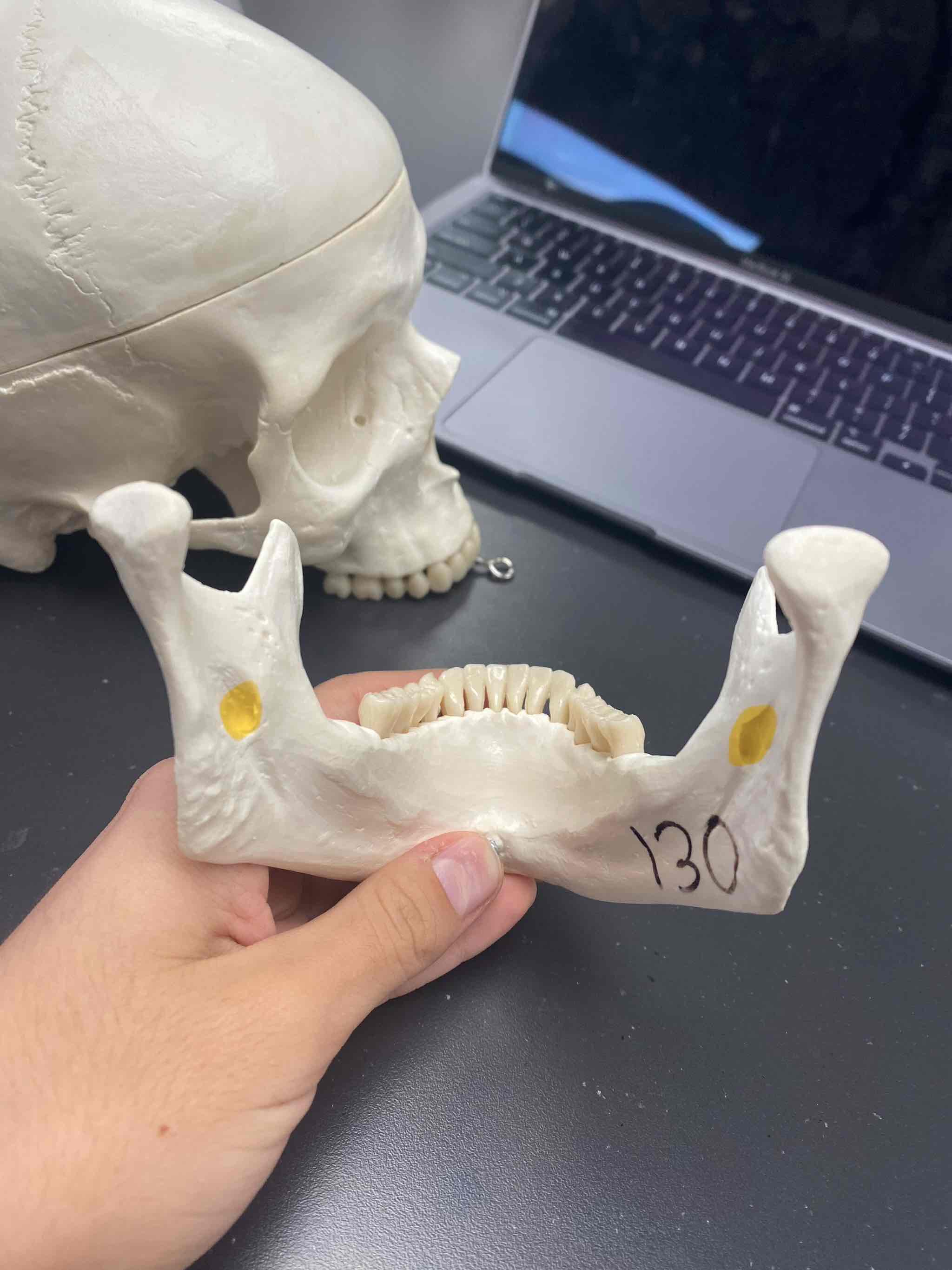 <p><span>name the bone and landmark</span></p>