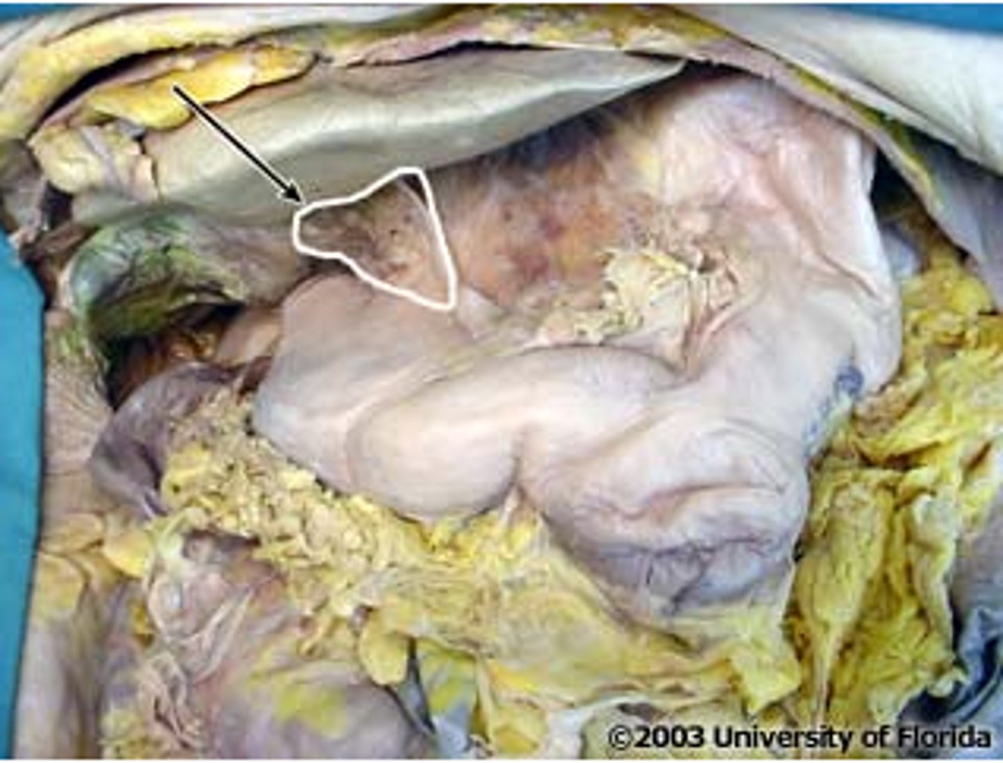 <p>what is in this structure</p>